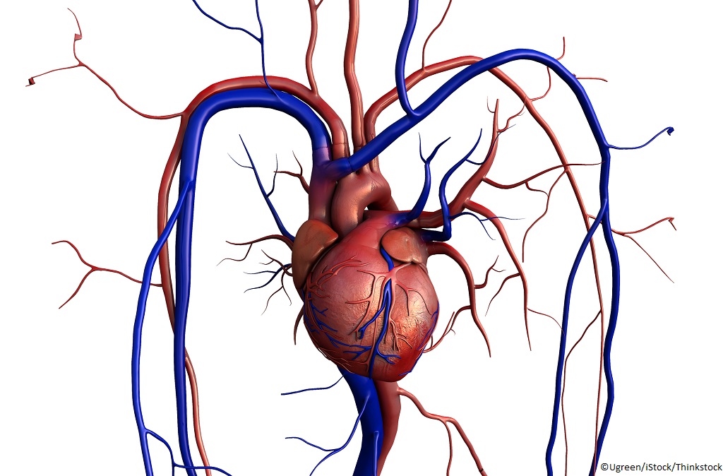 Défibrillateur automatique implantable – Institut de cardiologie