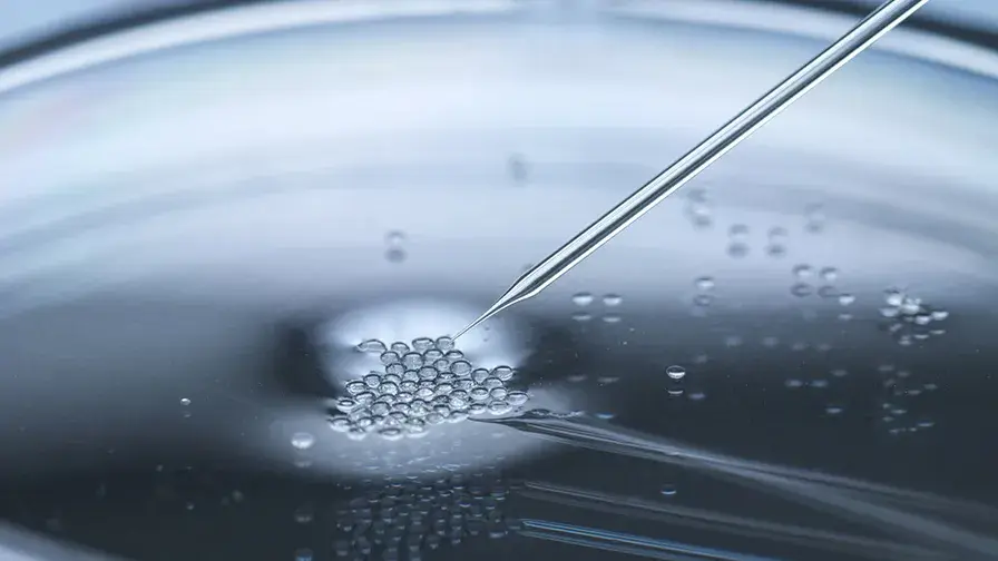 greffe allogénique de cellules souches hématopoïétiques