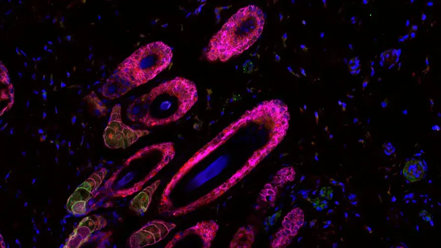 Co-marquages de peau de souris exprimant une mutation du gène PIK3CA