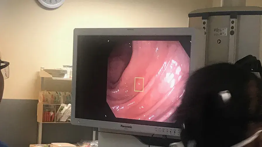 Dispositif d'aide à la détection précoce du cancer colorectal