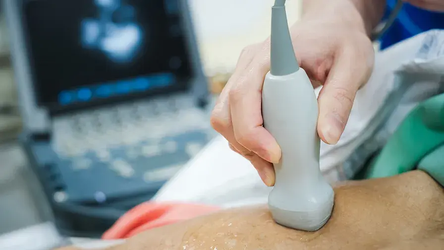 echographie cardiaque