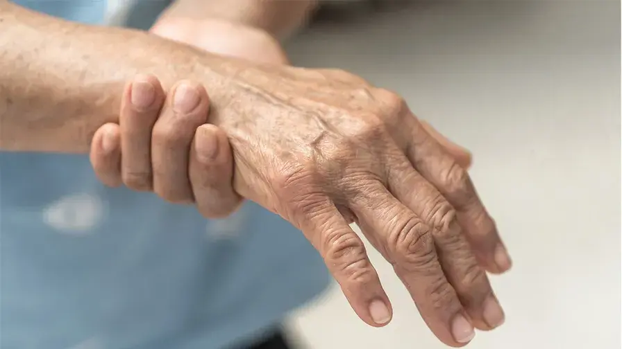 Mieux connaître la maladie de Sjögren