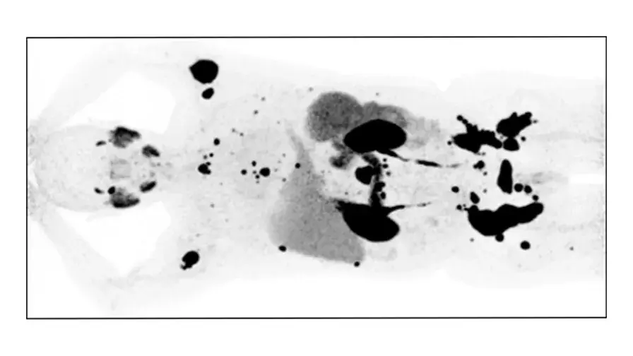 Une avancée majeure en médecine nucléaire et radiopharmacie à l'hôpital Henri-Mondor