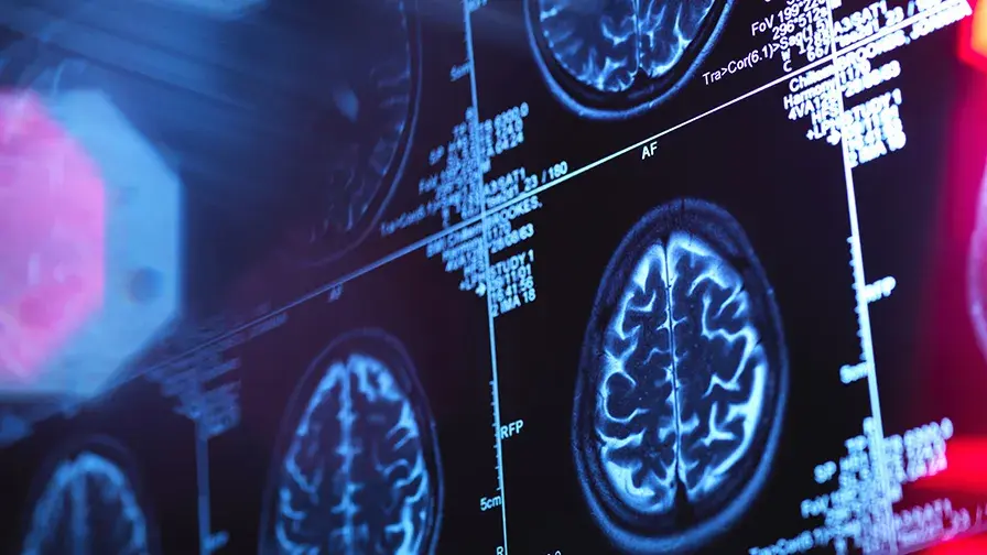 Scanner cerveau