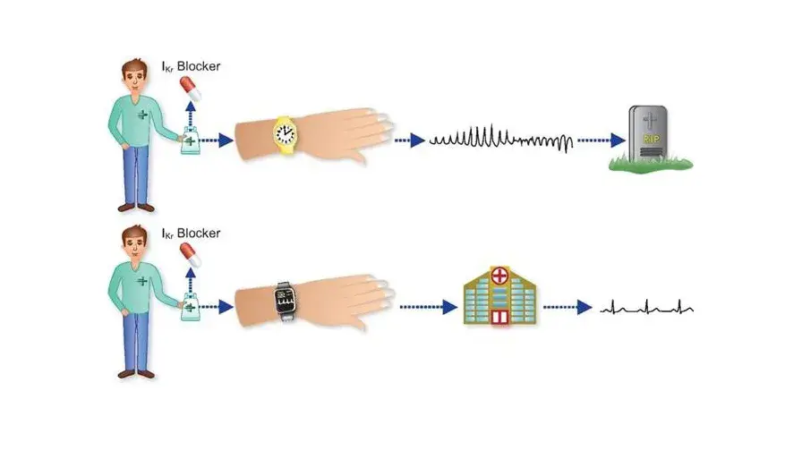 Schéma montrant comment l'intelligence artificielleAméliore la prévention des morts subites associées à la prise de médicaments