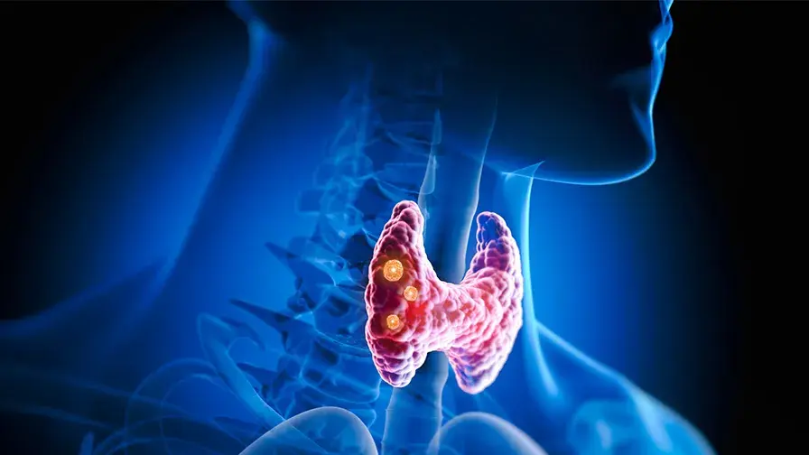 différence entre les glandes parathyroïdiennes pathologiques et les formations nodulaires thyroïdiennes grâce à l’échographie cervicale.