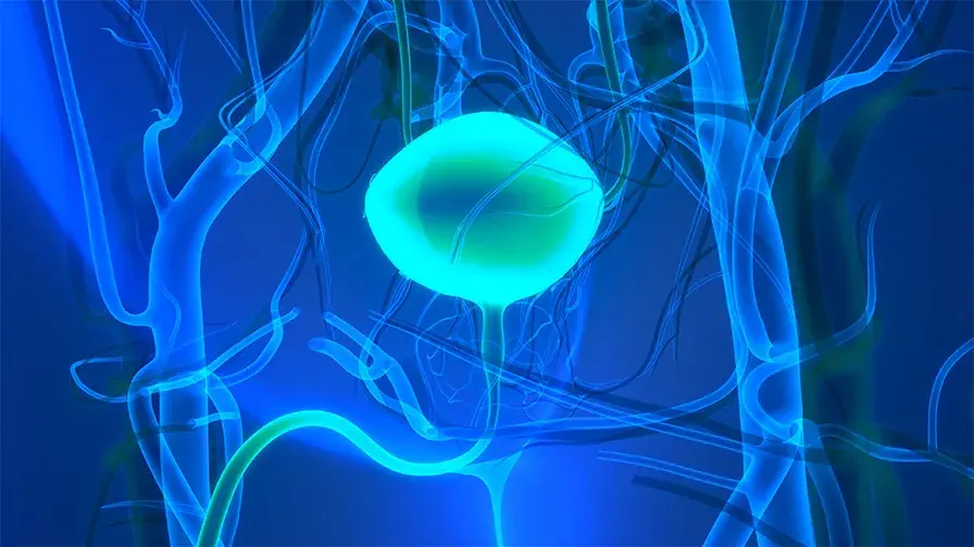 Cancer de la vessie localisé infiltrant le muscle  vers une évolution des pratiques 