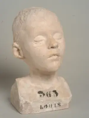 Hurel, Buste de Louis Joseph, moulage en plâtre, fin du XIXe siècle, Musée de l’Assistance publique – Hôpitaux de Paris, inv. AP 2004.0.1.4.37