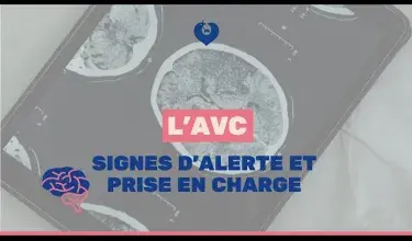 AVC : quels signes d'alerte et quelle prise en charge ?